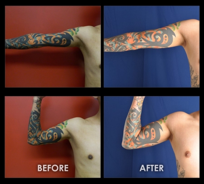 before-after-biceps-06