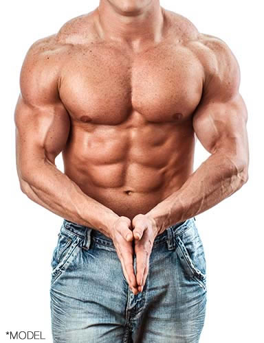 Pec Implants - Male Muscle Plastic Surgery