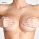 Breast Implants - Plastic Surgery